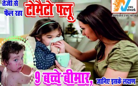 गोरखपुर में टोमैटो फ्लू का तेजी से बढ़ता कहर, 9 बच्चे मिले बीमार - जानें लक्षण और सावधानियां