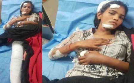 इंदिरा नगर में पति का बर्बर चेहरा, पत्नी पर किया हमला