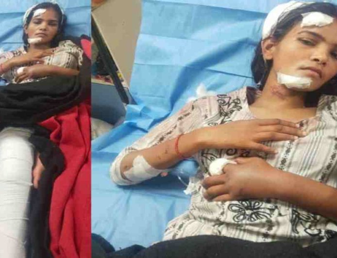 इंदिरा नगर में पति का बर्बर चेहरा, पत्नी पर किया हमला