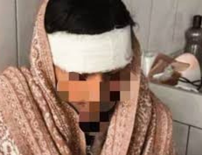 देहरादून में युवती पर हिंसक हमला: चंद्रबनी चौक की वारदात से बढ़ी सुरक्षा की चिंता